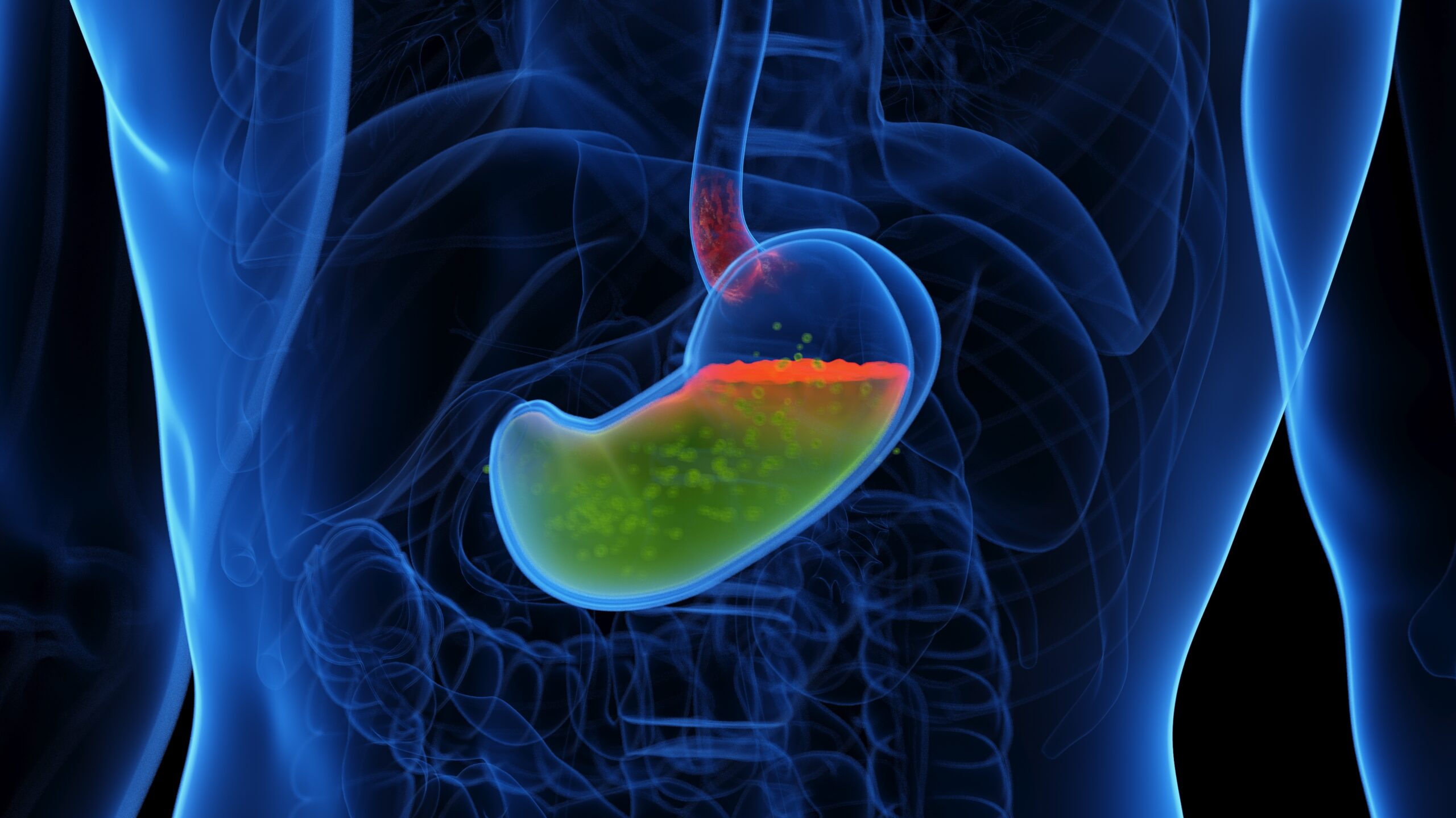 Pediatric Gastroesophageal Reflux Disease CEU