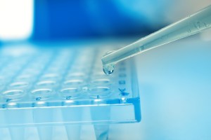 Stem cell CEU
