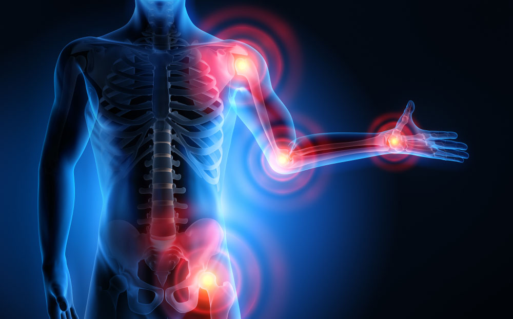 Painful Joints - 3D Illustration